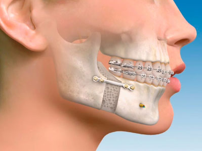 Cirugía Maxilofacial