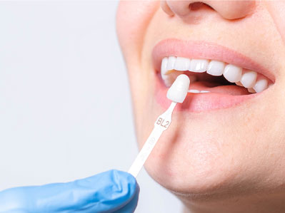 Rehabilitación Oral