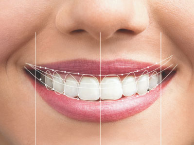 Diseño de Sonrisa