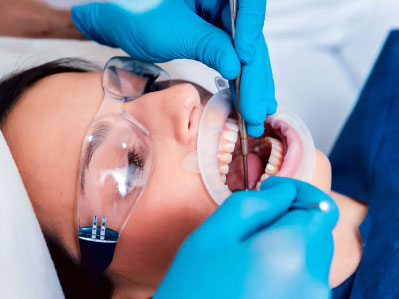 Endodoncia