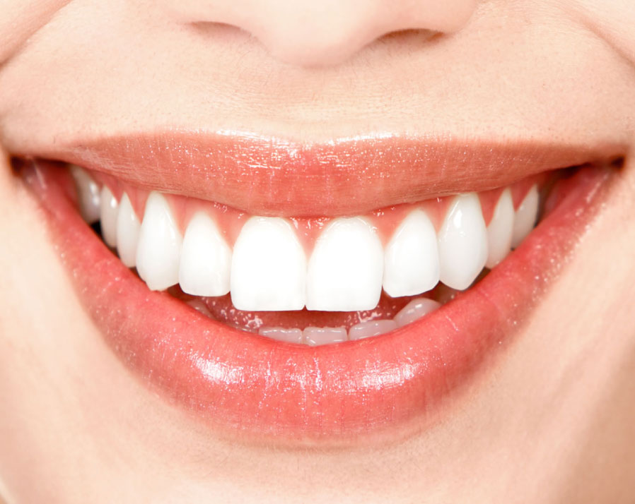 Diseño de Sonrisa